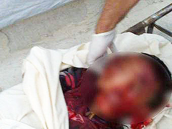 ανάπηρο+παιδί