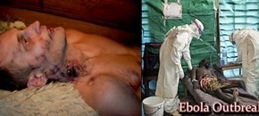 Κρούσμα φυματίωσης σε Φροντιστήριο Ξένων Γλωσσών στην&nbsp;Αθήνα.