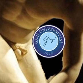 Τουρκία: «Κρύβουν» γυμνά αγάλματα μιμούμενοι τους…&nbsp;ταλιμπάν!