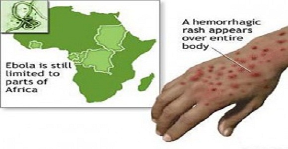 The-Ebola-Outbreak-Is-Spreading-Pray-to-God-It-Doesn’t-Hitch-A-Ride-To-The-West