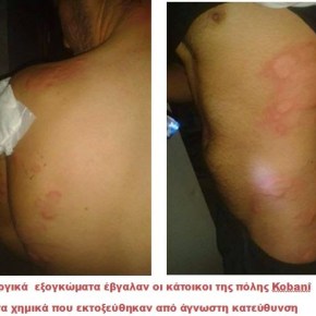 KOBANÎ: Επίθεση με χημικά όπλα χθες το&nbsp;βράδυ