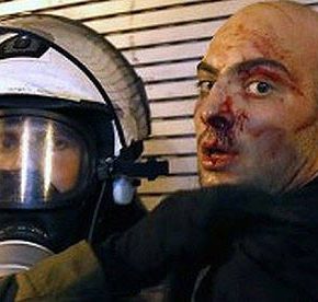 Σάλος στο διαδίκτυο με τη φωτογραφία του ματωμένου διαδηλωτή στα χέρια των&nbsp;ΜΑΤ