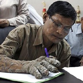 PAPILOMA «Η ΚΑΤΑΡΑ» ΤΗΣ ΔΙΕΣΤΡΑΜΜΕΝΗΣ ΕΠΟΧΗΣ&nbsp;ΜΑΣ