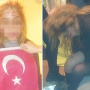 Μια ζωή ζώα θα μείνετε!!! Έξι Τουρκάλες βασάνισαν Κούρδισσα φοιτήτρια και το ανάρτησαν στο WhatsApp…&nbsp;(Φώτο)