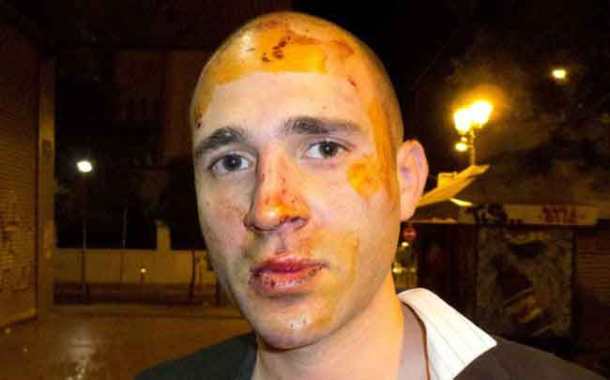 619a2492f161c8b8b9241e6b45d14e78