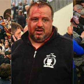 ΕΚΤΑΚΤΟ: Μιλάνε πλέον τα όπλα στην ΠΓΔΜ – Χαροπαλεύει ο Πρόεδρος του αλβανικού κόμματος – Αρχή εμφυλίου πολέμου και συγκρούσεις παραστρατιωτικών δυνάμεων – Ζωντανή&nbsp;μετάδοση