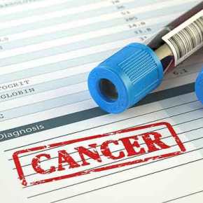 Ελπίδες για θεραπεία της λευχαιμίας – Έλληνες επιστήμονες βρήκαν ουσία που την&nbsp;καταπολεμά