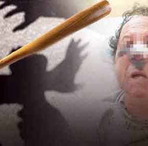 Άγριος ξυλοδαρμός τουρίστα στα Εξάρχεια από Αλγερινούς&nbsp;«πρόσφυγες»